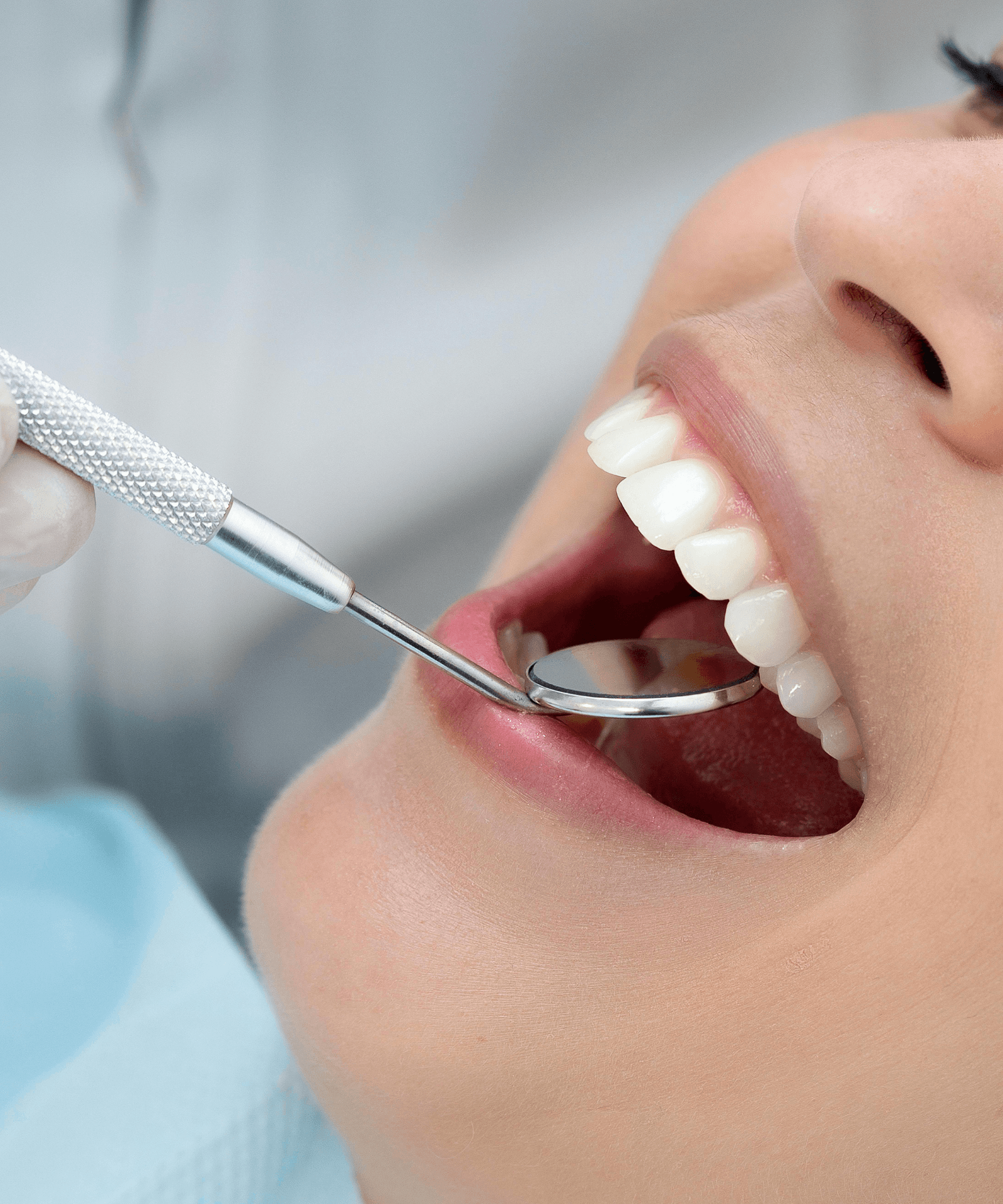 Composite Bonding